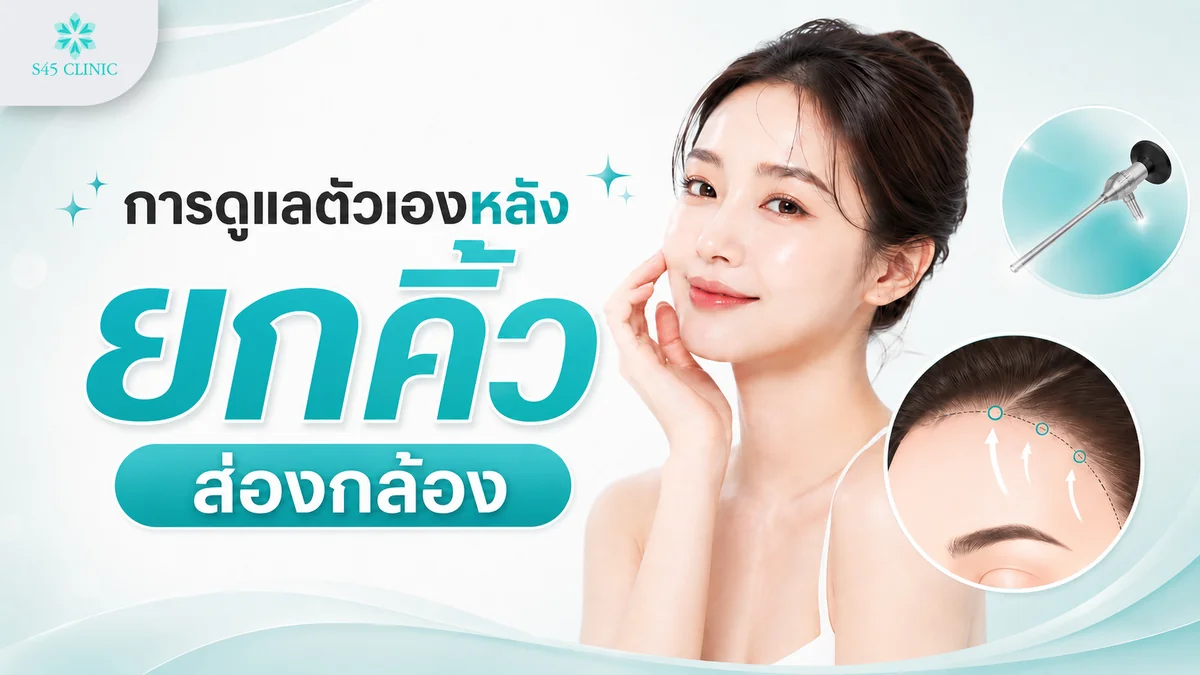 การดูแลตัวเองหลังยกคิ้วส่องกล้อง ประคบและนอนศีรษะสูง งดออกกำลังกาย ดูแลแผล