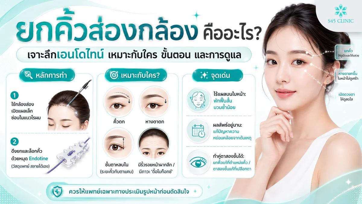 ยกคิ้วส่องกล้อง เอนโดไทน์ คืออะไร แก้ปัญหาคิ้วตกหางตาตกให้ใบหน้าดูสดใส