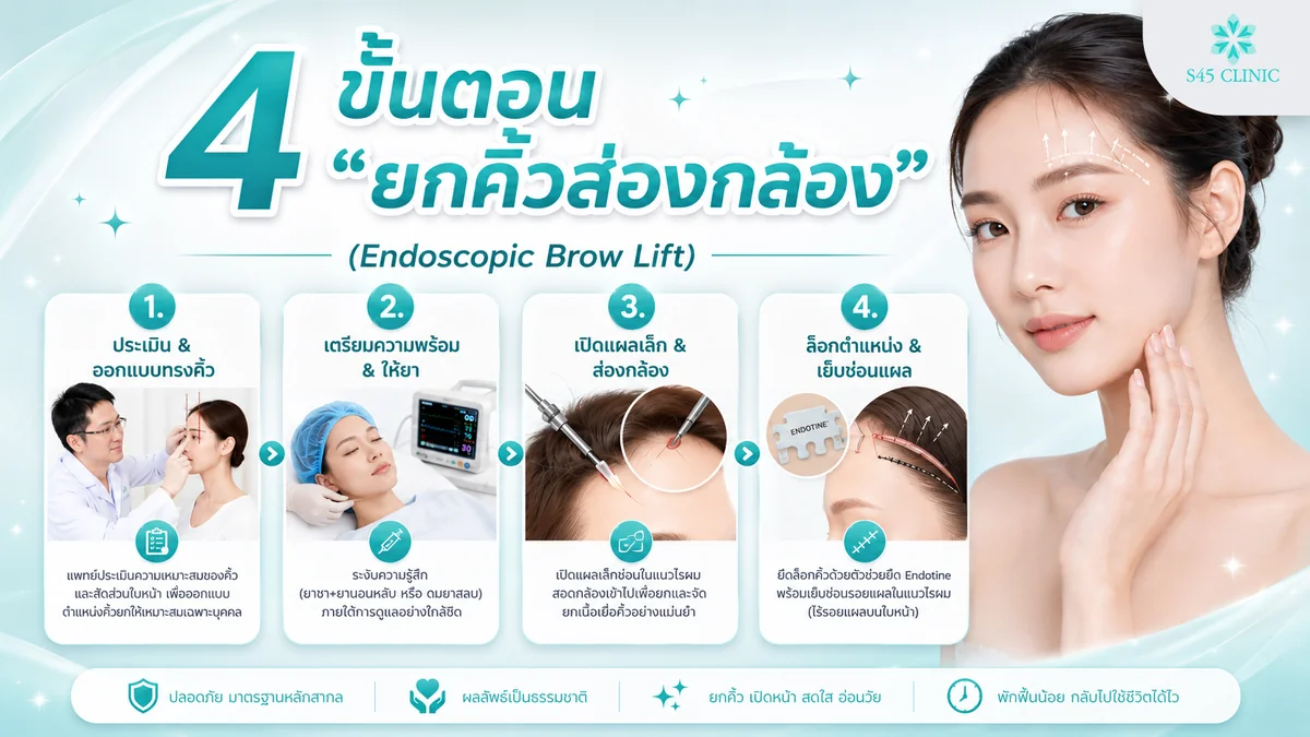ขั้นตอนยกคิ้วส่องกล้อง ตั้งแต่ประเมินใบหน้า เปิดแผลในไรผม ยึดเอนโดไทน์