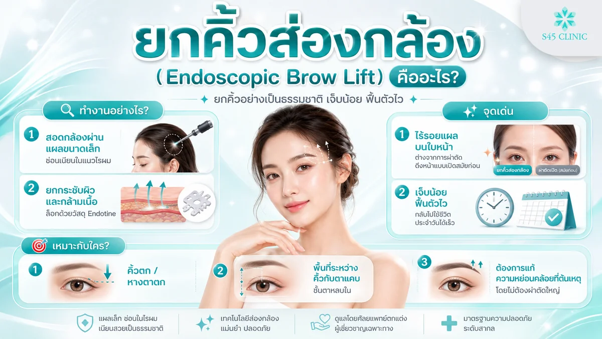 ยกคิ้วส่องกล้อง Endoscopic Brow Lift คืออะไร ทำงานอย่างไร เหมาะกับใคร