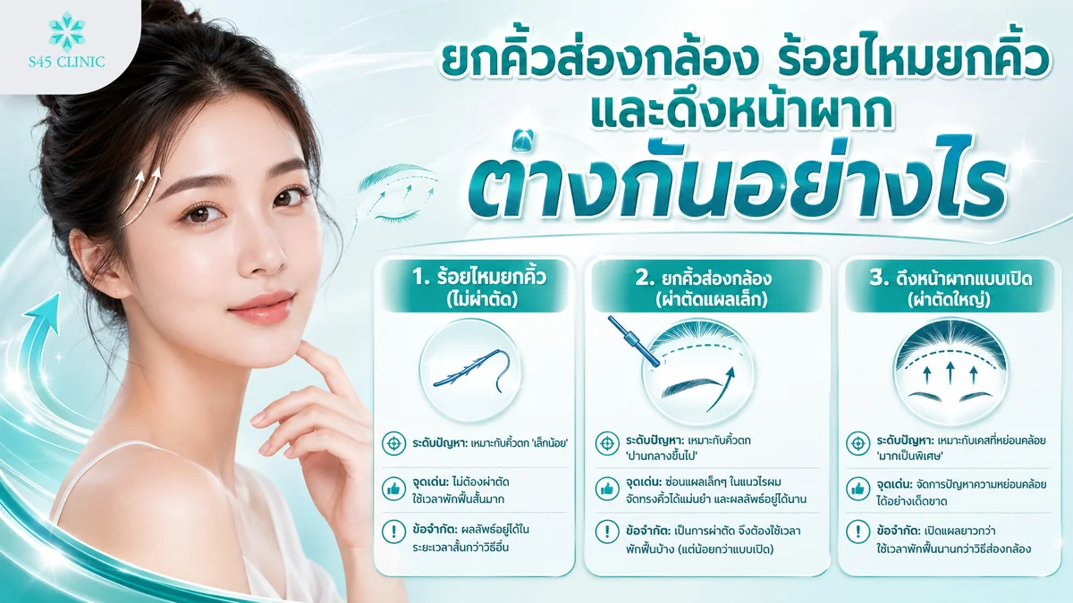 เปรียบเทียบยกคิ้วส่องกล้อง ร้อยไหมยกคิ้ว และดึงหน้าผากแบบเปิด