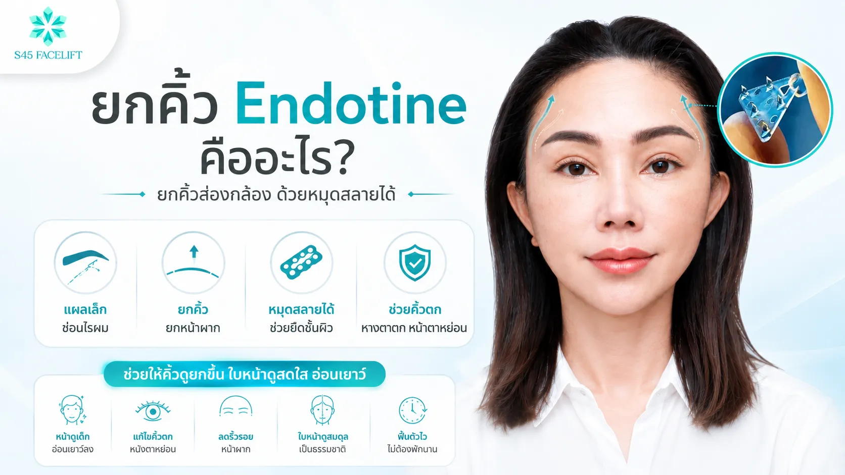 endotine brow lift cover