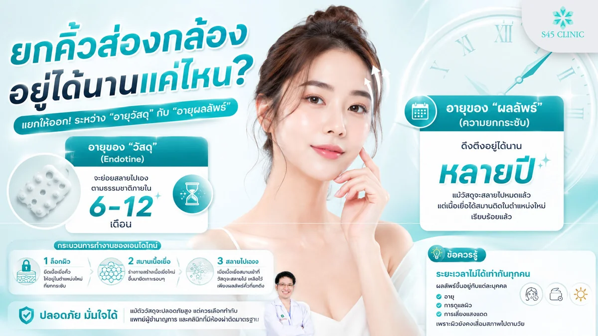 ไทม์ไลน์ผลลัพธ์ยกคิ้วส่องกล้อง วัสดุสลายและผลคงอยู่หลายปี