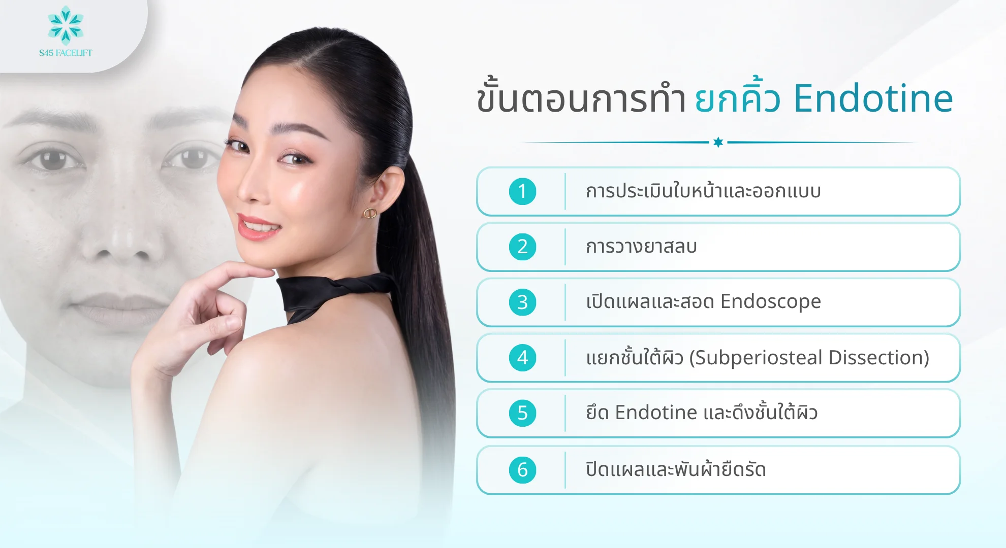 ขั้นตอนการทำยกคิ้ว Endotine 6 ขั้นตอน ตั้งแต่ออกแบบจนจบ