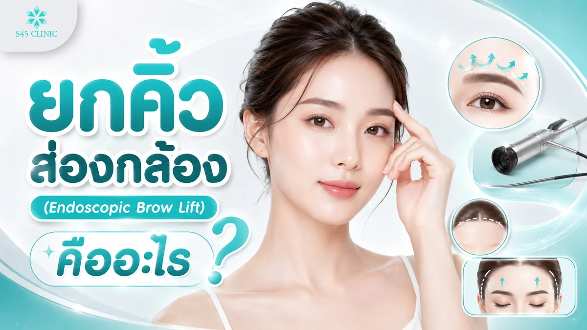 ลักษณะการยกคิ้วส่องกล้องผ่านกล้องขนาดเล็ก แผลซ่อนในแนวไรผม