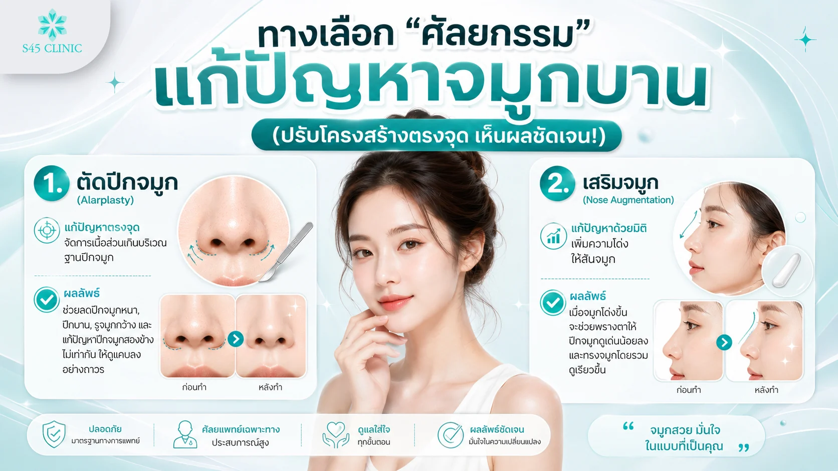 ทางเลือกศัลยกรรมสำหรับจมูกบาน ตัดปีกจมูกและเสริมจมูก