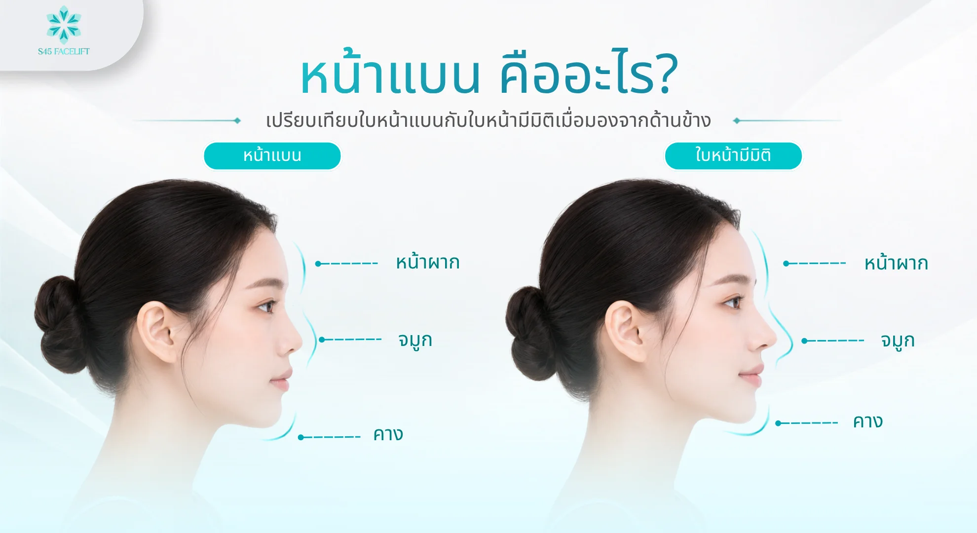 หน้าแบน คืออะไร