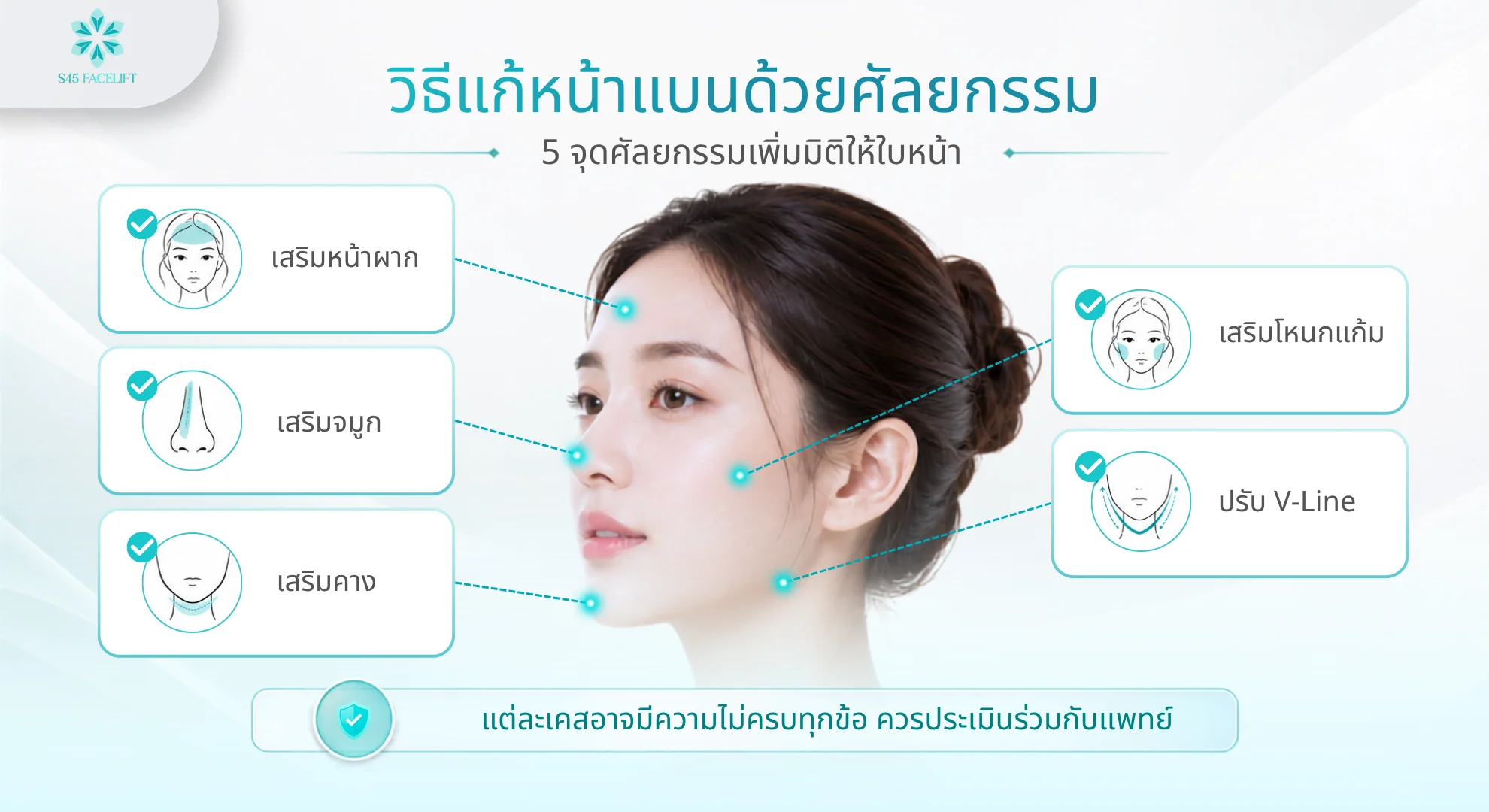 หน้าแบน วิธีแก้แบบผ่าตัด