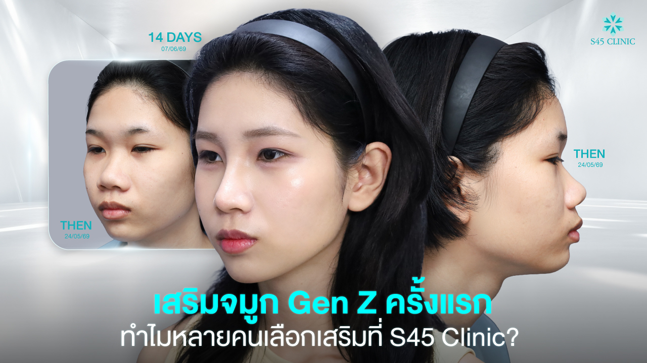 gen z first rhinoplasty