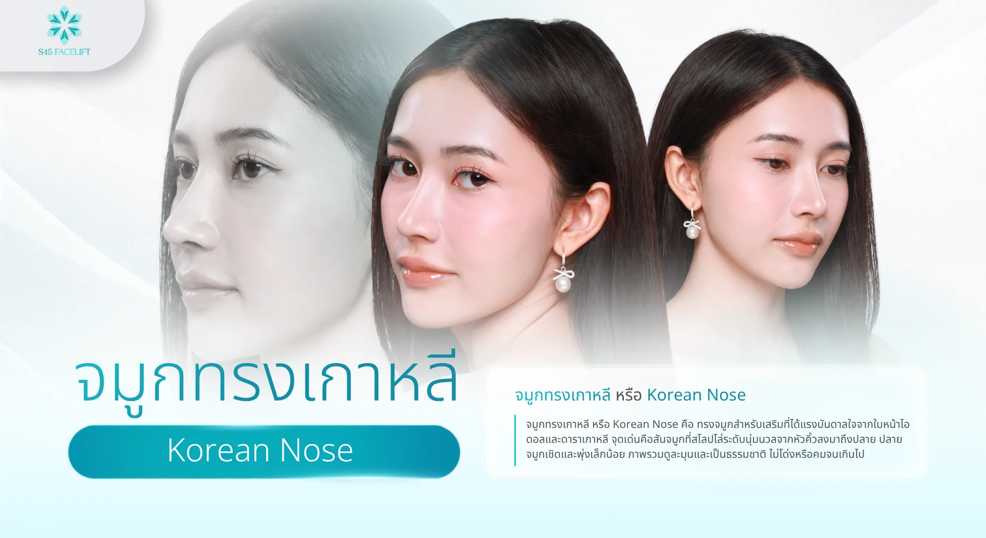 จมูกทรงเกาหลี คืออะไร