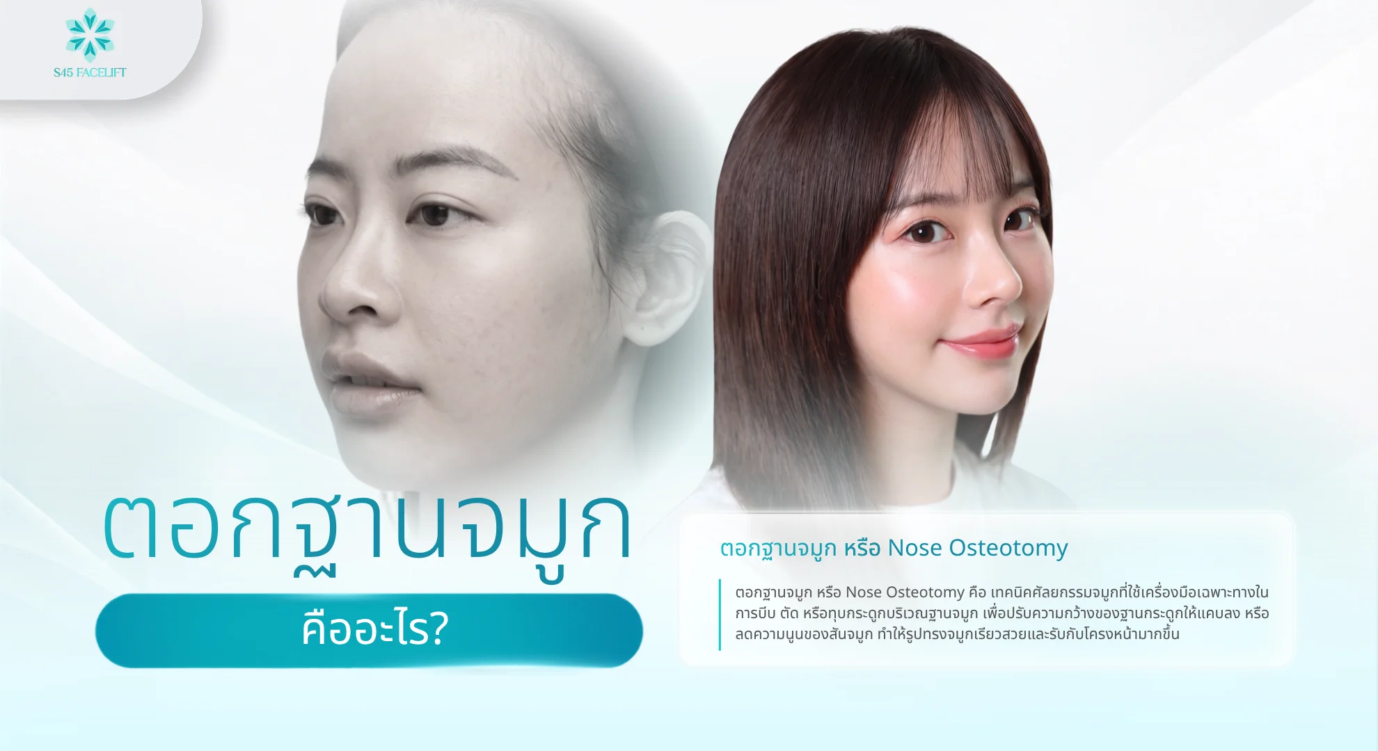 ตอกฐานจมูก คืออะไร