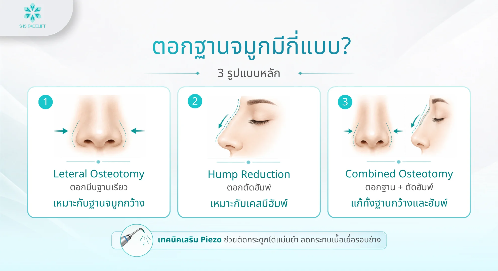 ตอกฐานจมูก เทคนิค