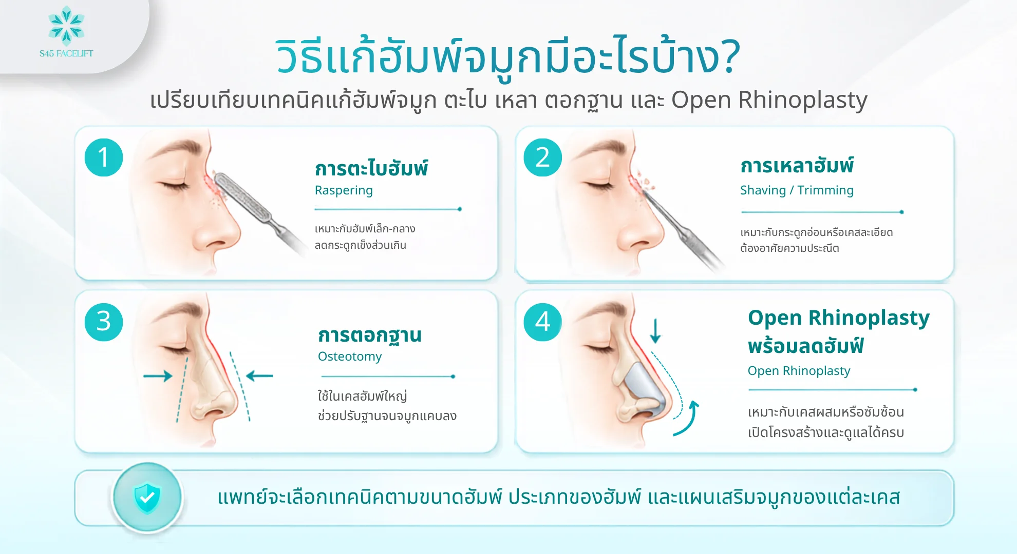 ฮัมพ์จมูก วิธีแก้