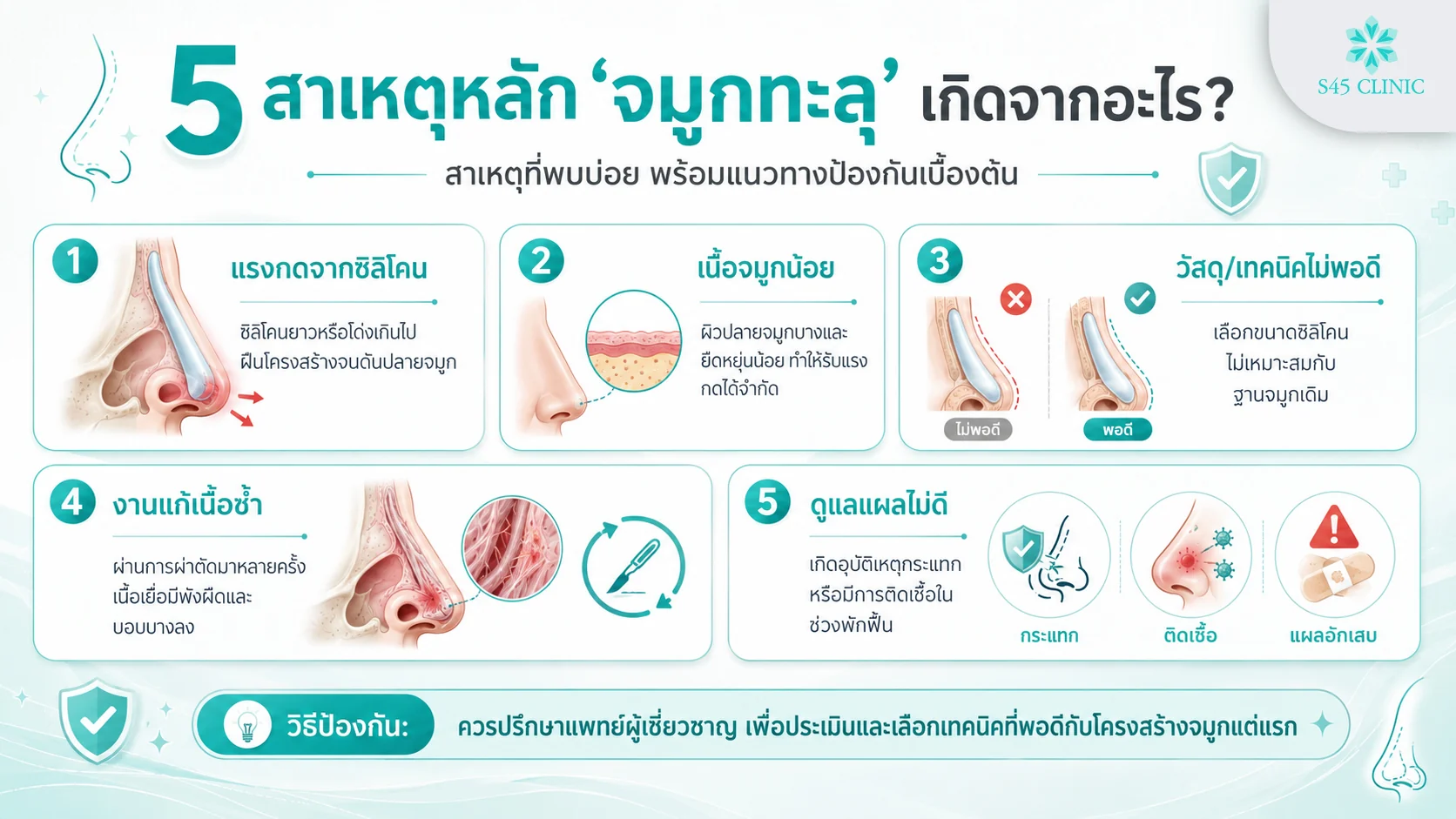 5 สาเหตุจมูกทะลุ แรงกดซิลิโคน เนื้อจมูกน้อย วัสดุเทคนิคไม่พอดี งานแก้ และดูแลแผลไม่ดี