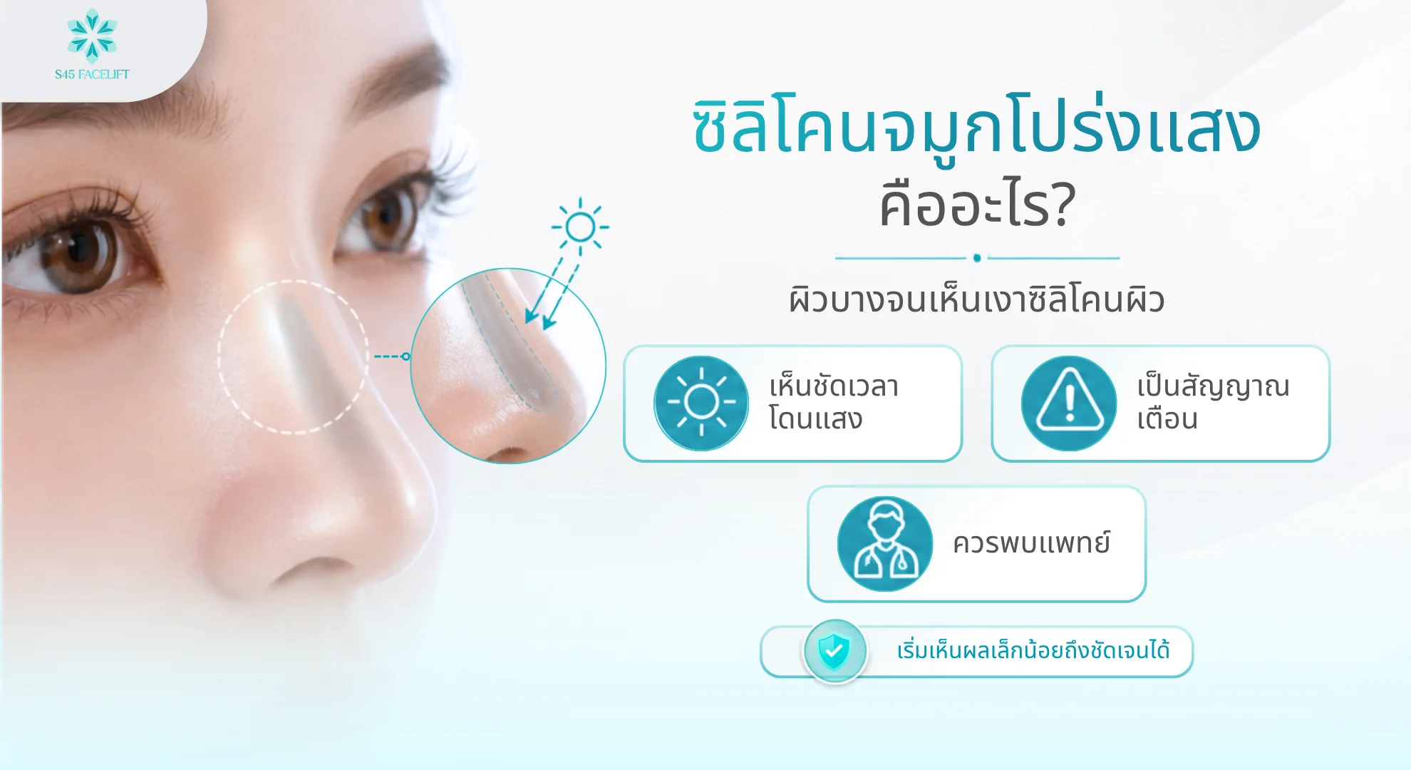 ซิลิโคนจมูกอยู่ได้กี่ปี ซิลิโคนโปร่งแสง