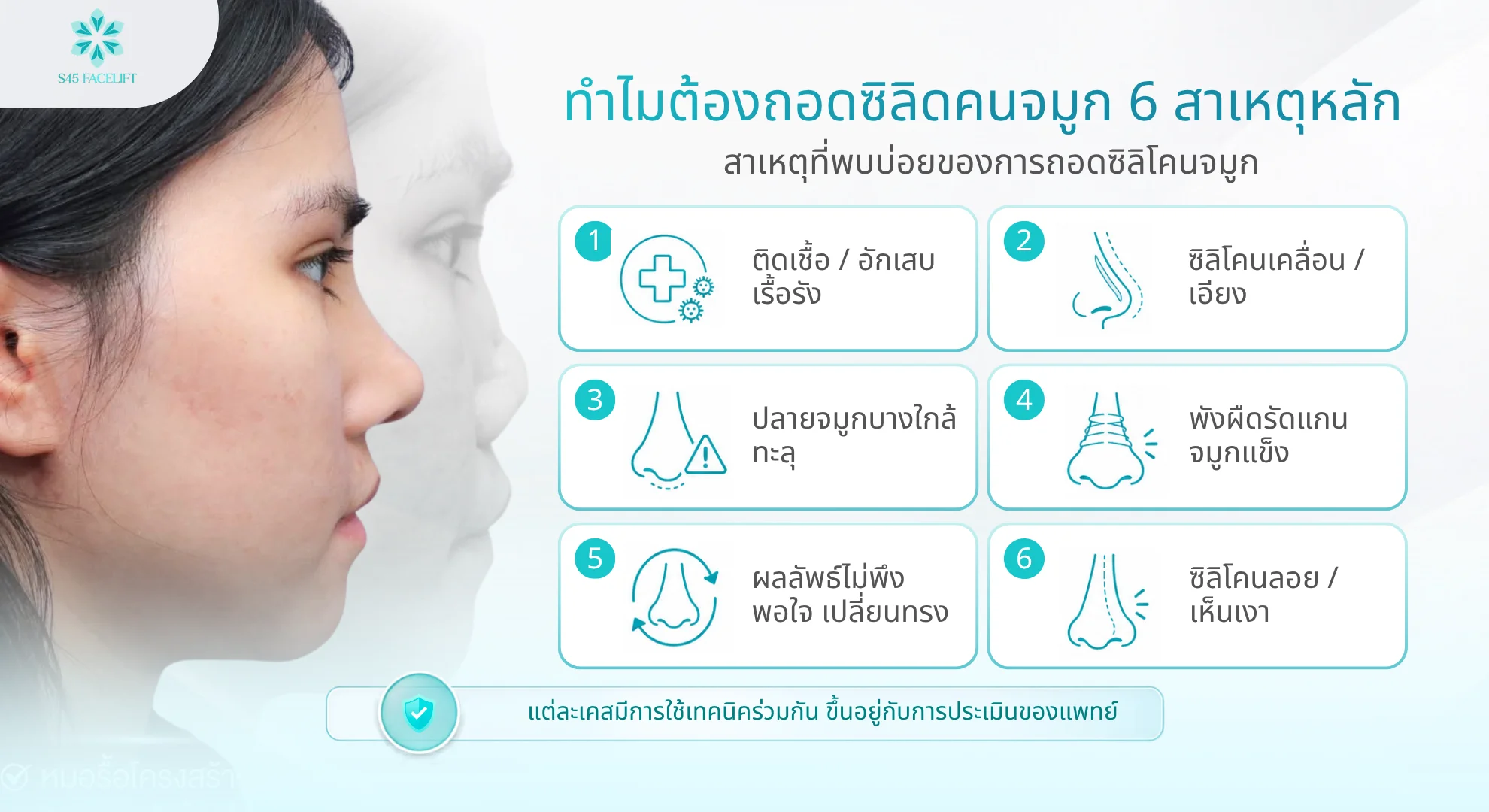 ถอดซิลิโคนจมูก สาเหตุที่ต้องถอด