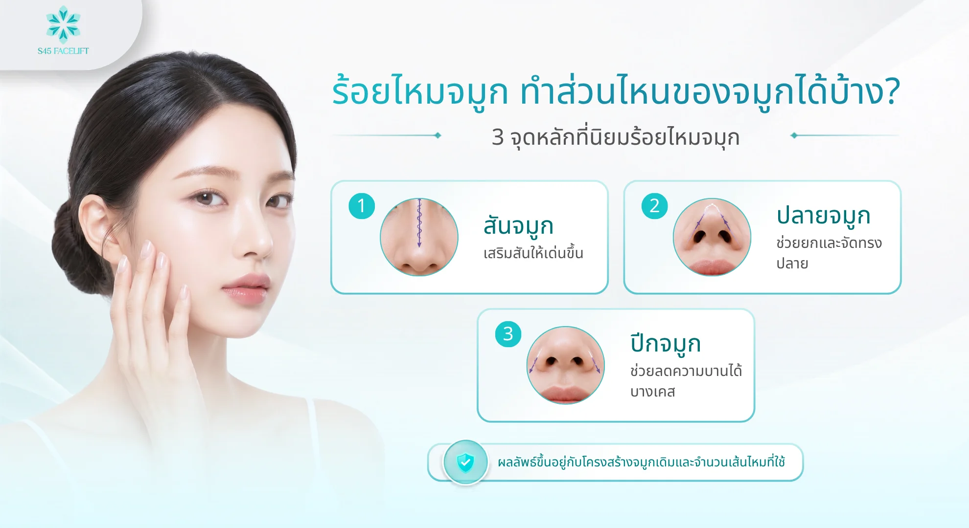 ร้อยไหมจมูก ตำแหน่งที่ร้อยไหม