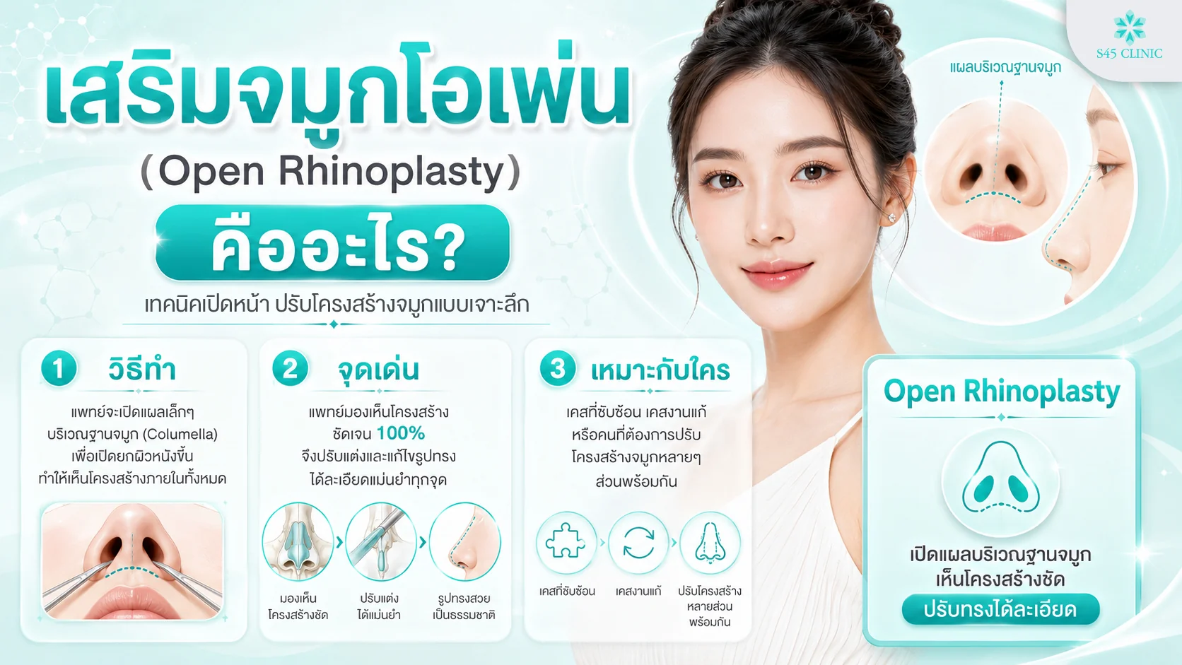 Open nose surgery คือเทคนิคศัลยกรรมจมูกแบบเปิด เปิดแผลฐานจมูกเห็นโครงสร้าง