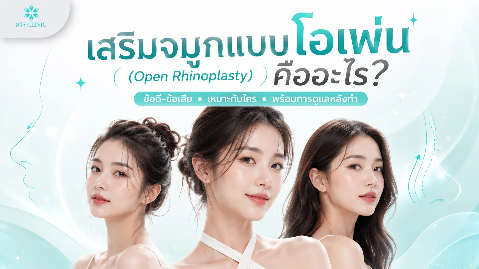 เสริมจมูกแบบโอเพ่น (Open Rhinoplasty) คืออะไร ข้อดี-ข้อเสีย เหมาะกับใคร และการดูแลหลังทำ