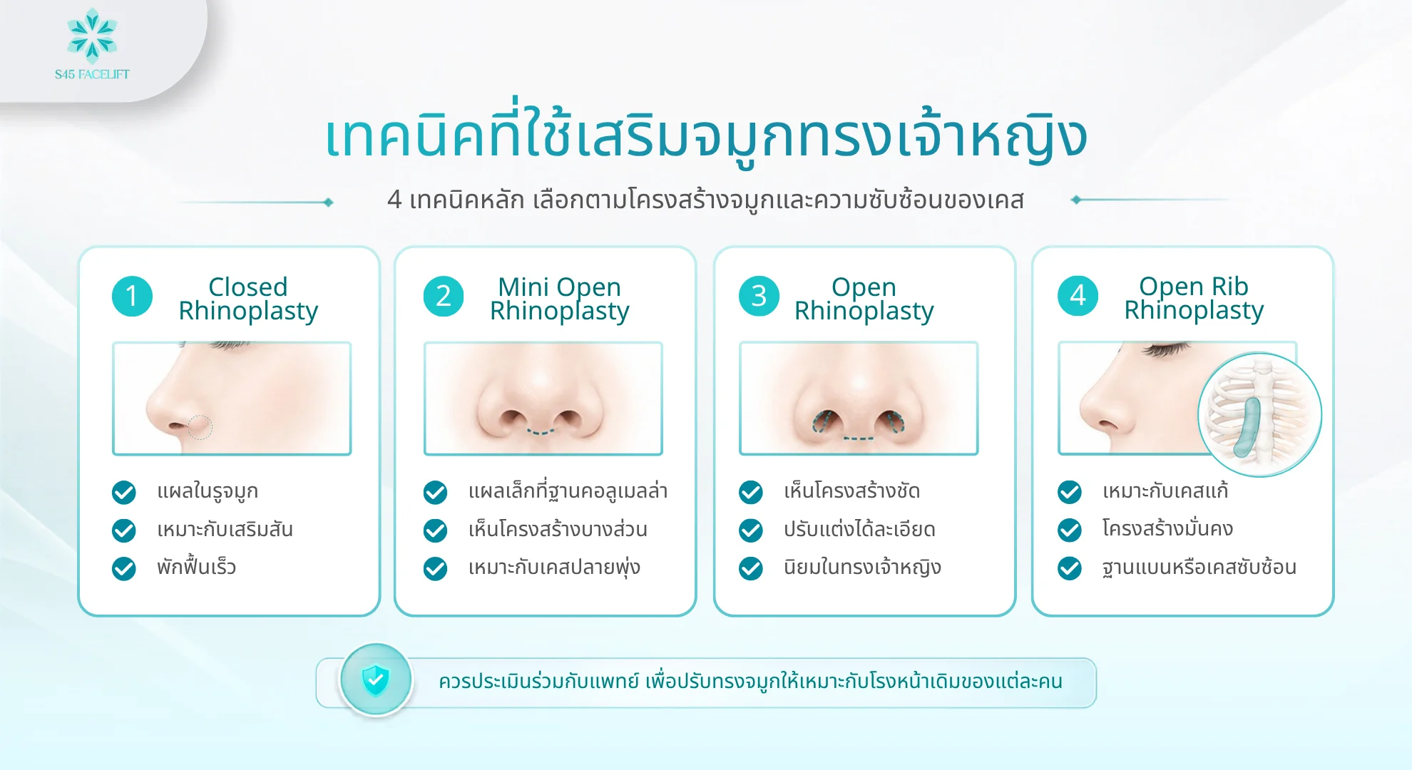เสริมจมูกทรงเจ้าหญิงด้วยเทคนิค Open Rhinoplasty และเทคนิค Closed