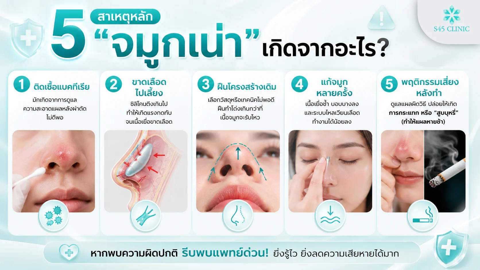 สาเหตุของจมูกเน่า ติดเชื้อ ขาดเลือดไปเลี้ยง และปัจจัยอื่น