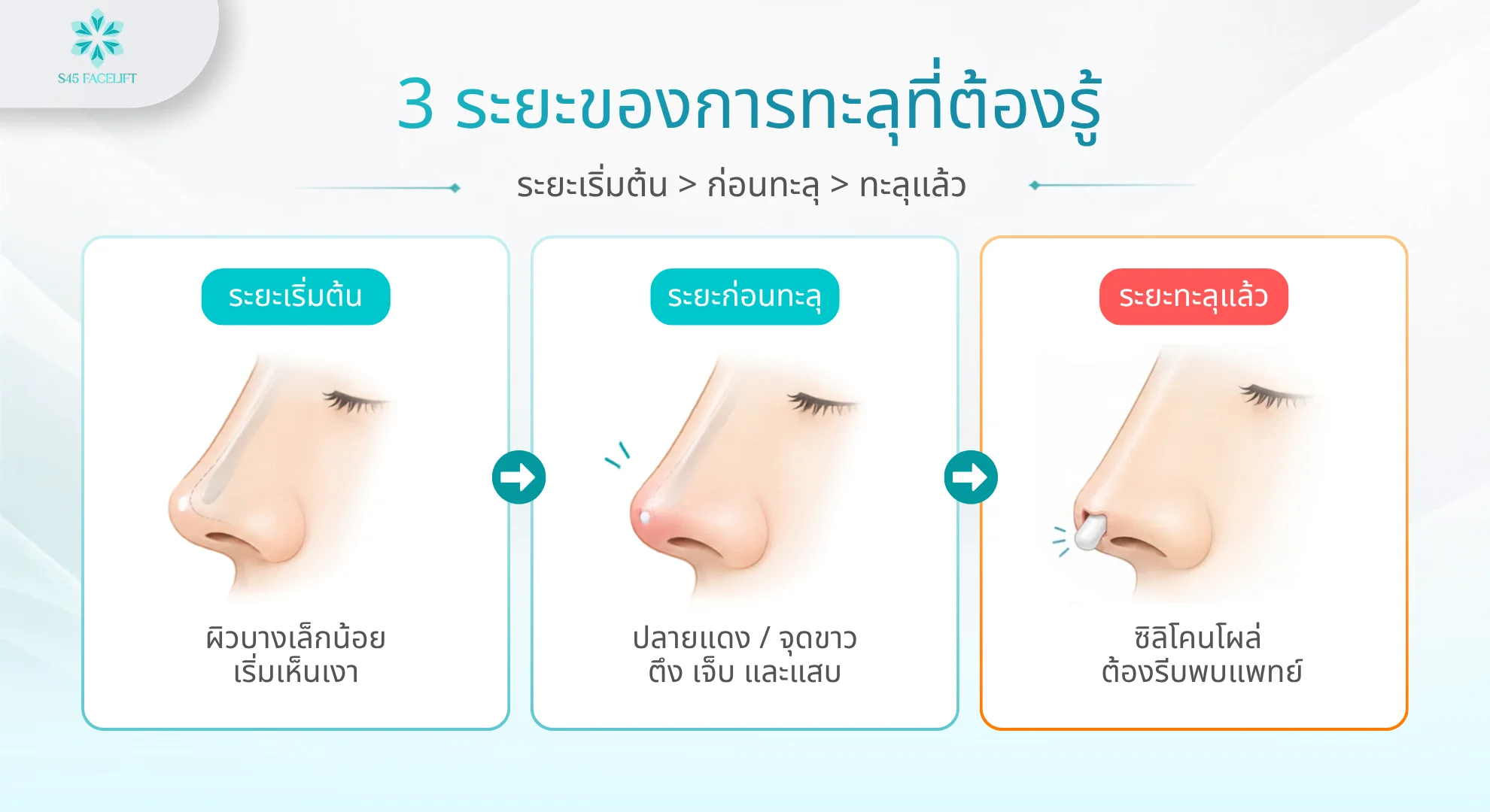 ซิลิโคนทะลุในรูจมูก ระยะของอาการ