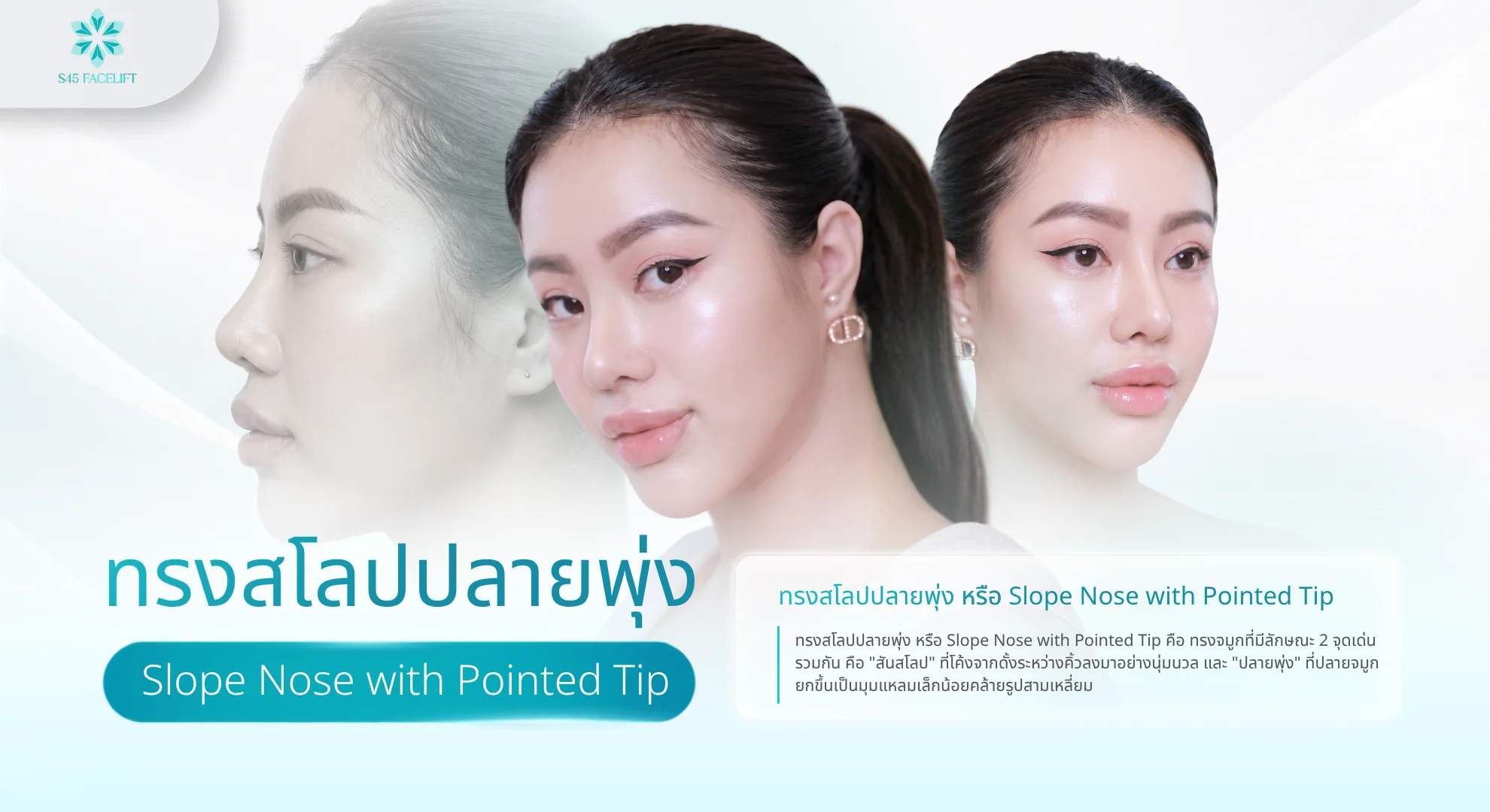 ทรงสโลปปลายพุ่ง คืออะไร