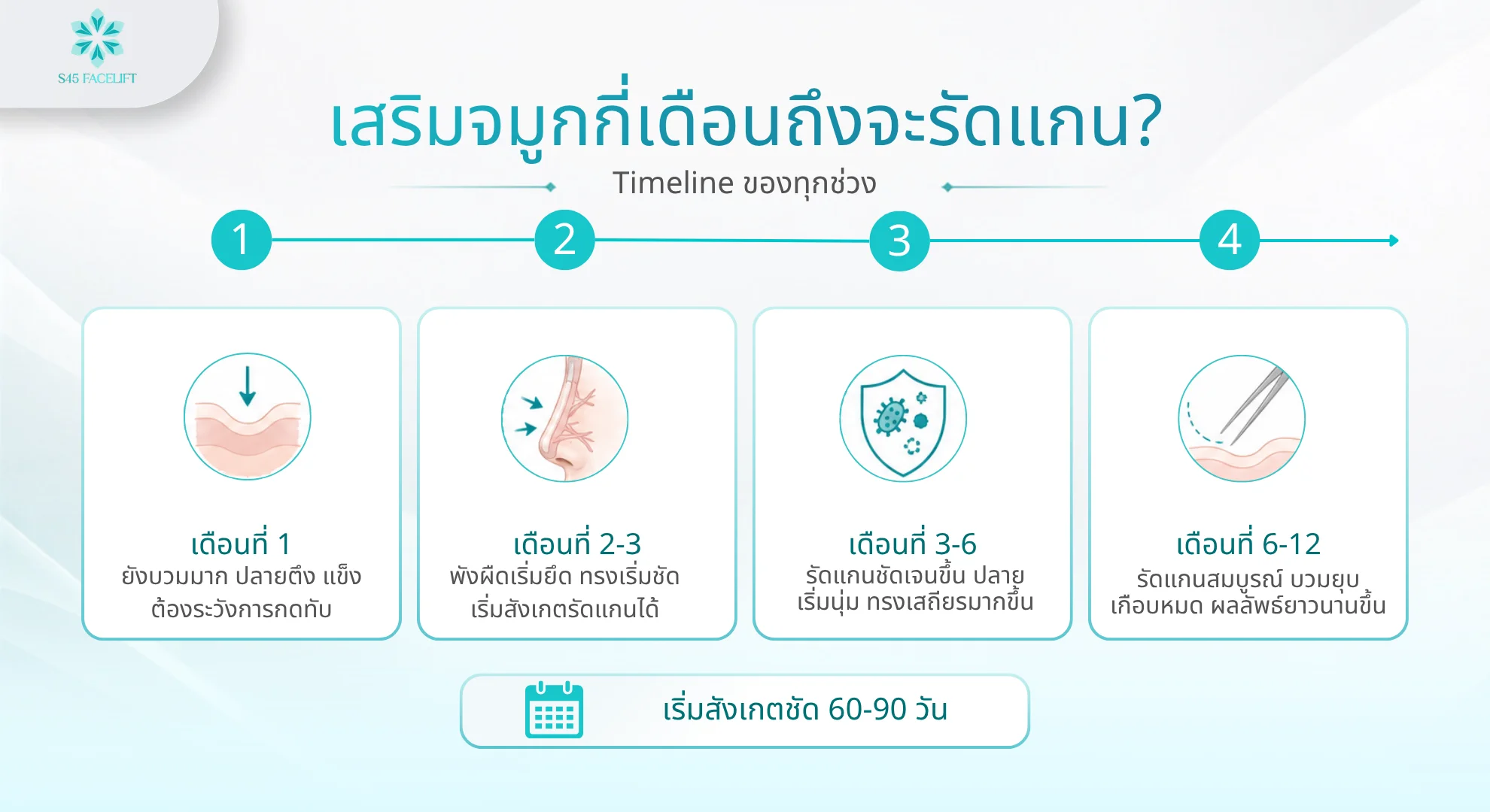 Timeline จมูกรัดแกน เดือนที่ 1 บวมเริ่มเข้าที่ 2-3 พังผืดเริ่มยึด 3-6 รัดแกนชัดเจน และ 6-12 สมบูรณ์