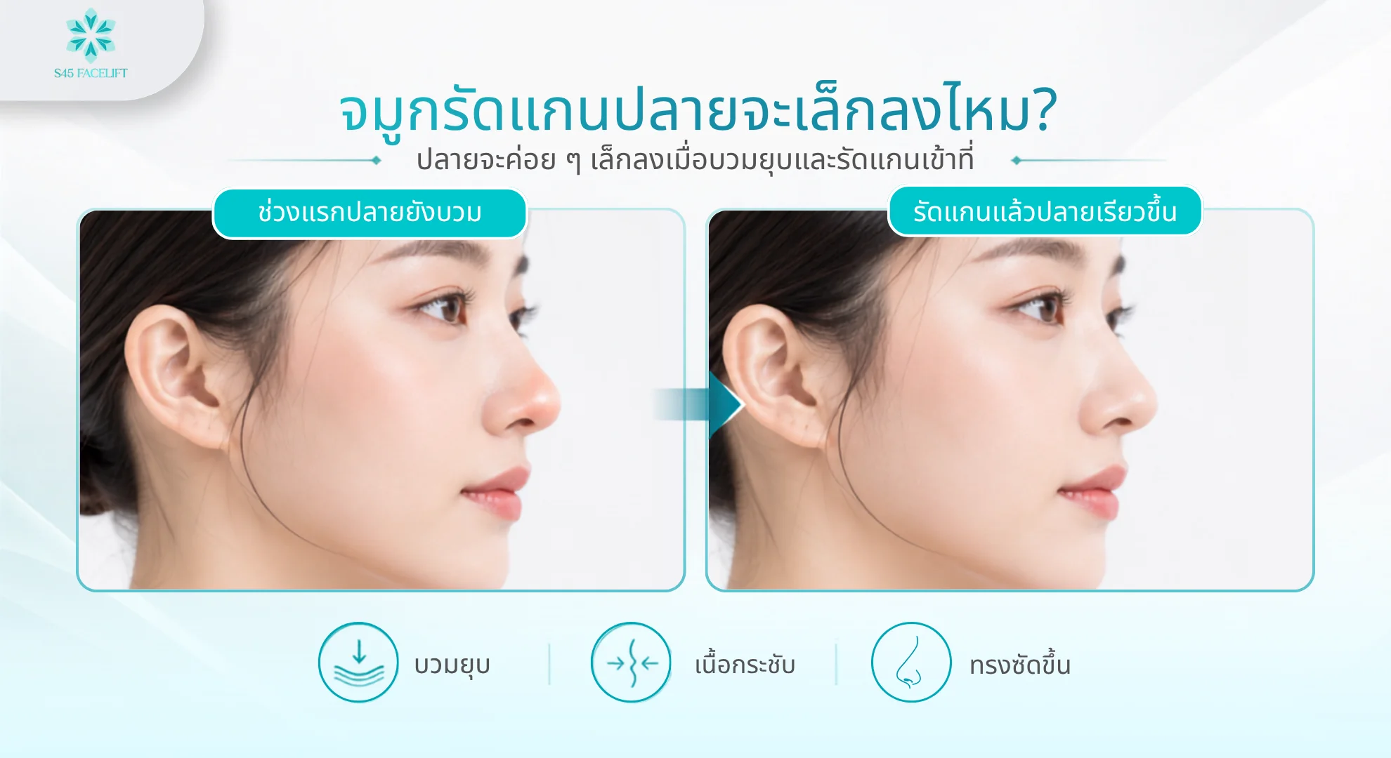 จมูกรัดแกนปลายจะเล็กลงไหม ก่อน-หลัง