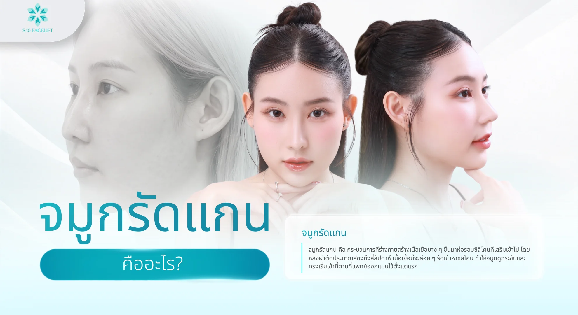 จมูกรัดแกนปลายจะเล็กลงไหม คืออะไร