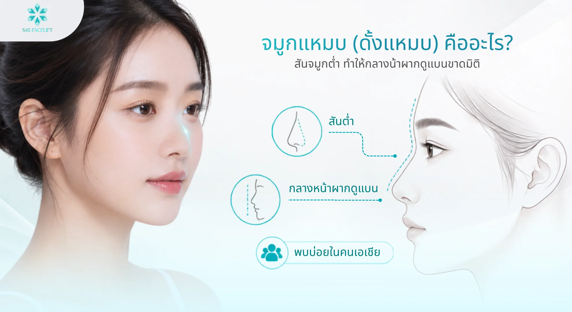 จมูกแหมบ ดั้งแหมบคืออะไร สาเหตุ วิธีแก้ทั้งไม่ผ่าตัดและผ่าตัด