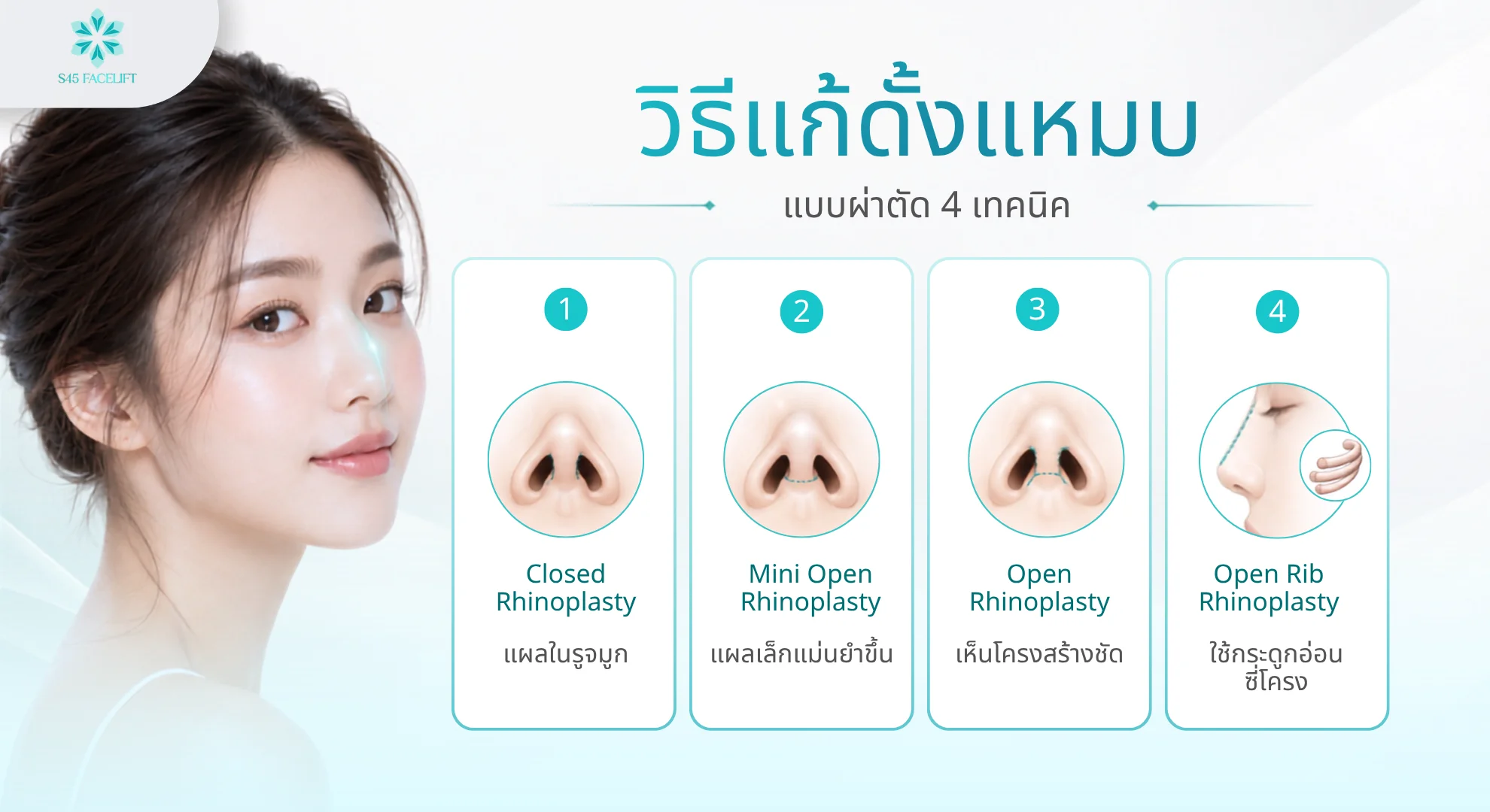 4 เทคนิคแก้ดั้งแหมบด้วยการผ่าตัด Closed Mini Open Open และ Open Rib Rhinoplasty