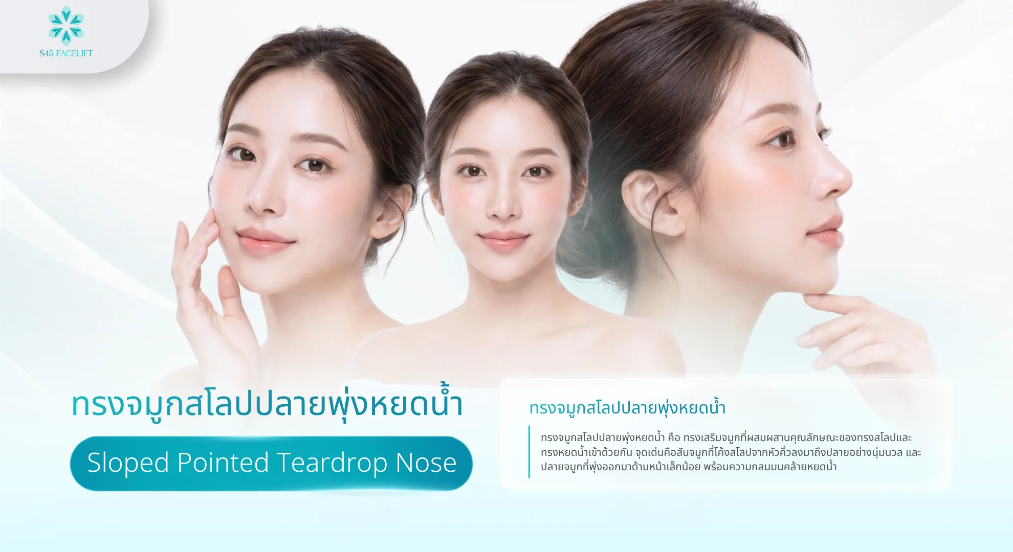 ทรงจมูกสโลปปลายพุ่งหยดน้ำ คืออะไร