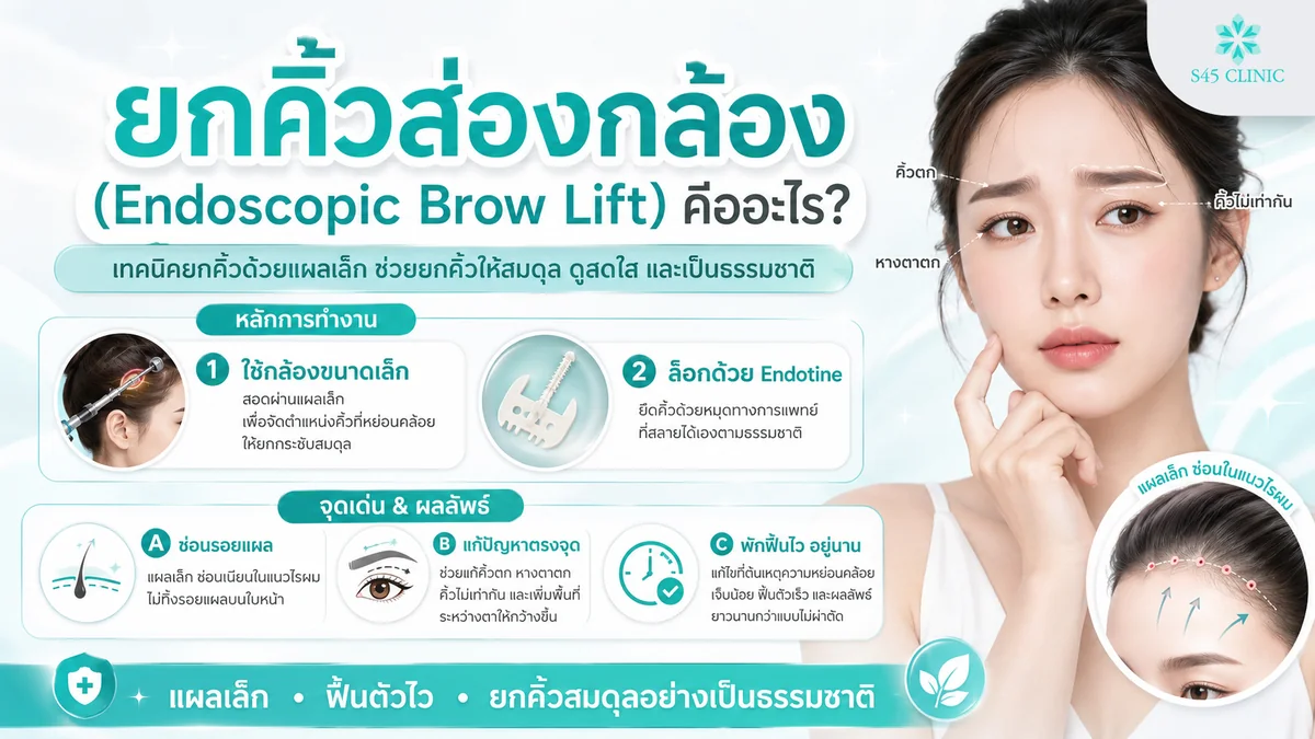 หลักการยกคิ้วส่องกล้องเอนโดไทน์ แผลเล็กซ่อนในไรผม ปรับระดับคิ้วให้สมดุล