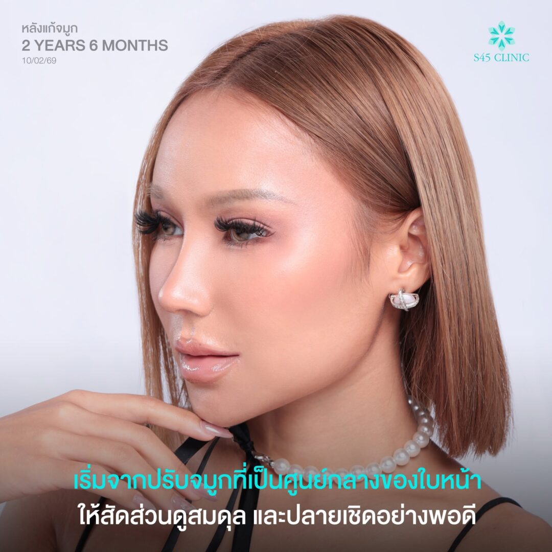 จมูกทรงสาวอินเตอร์ (Mixed Style)