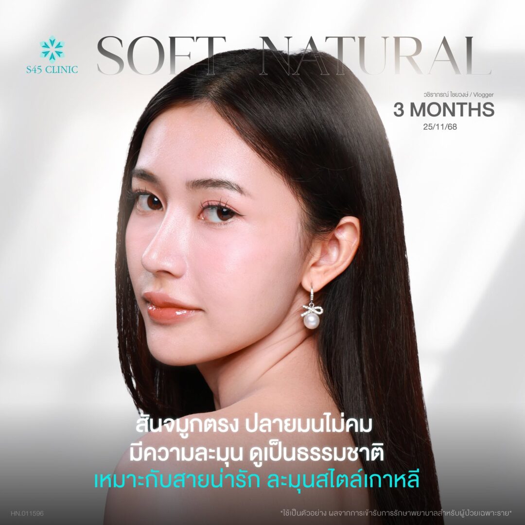 จมูกทรงเกาหลี (Korean Style)