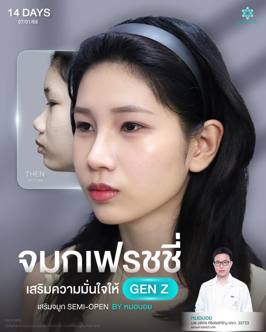จมูกเจนซี