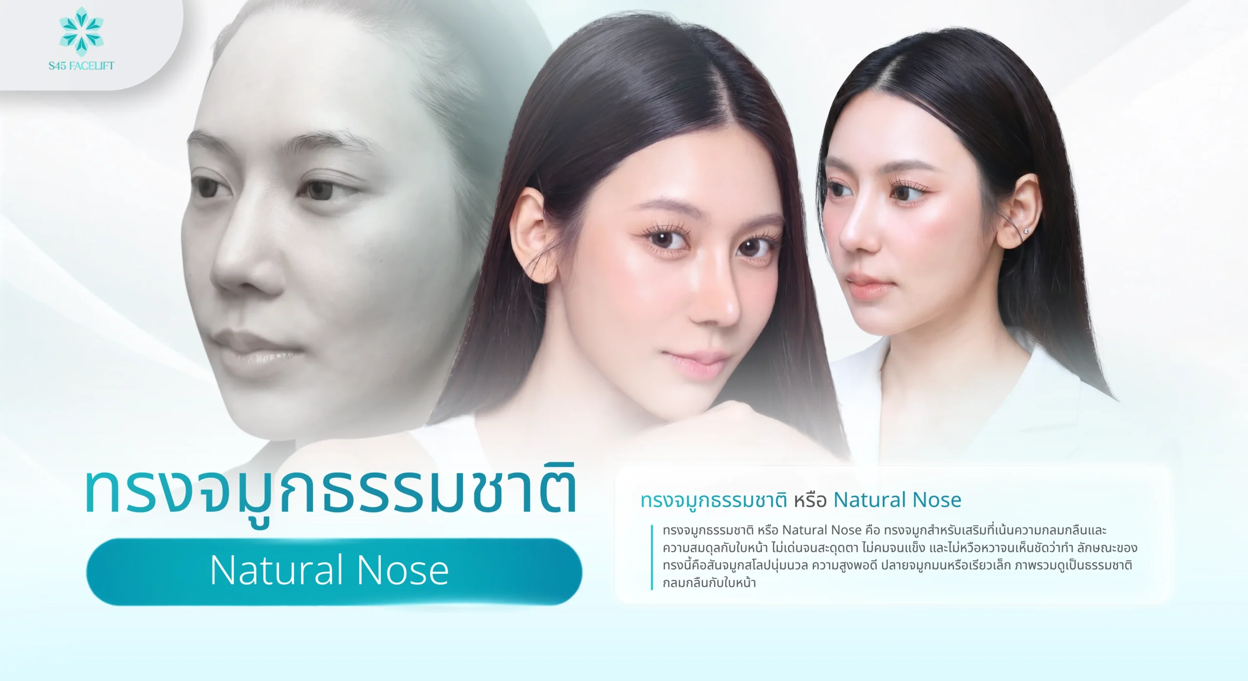 ทรงจมูกธรรมชาติ 1