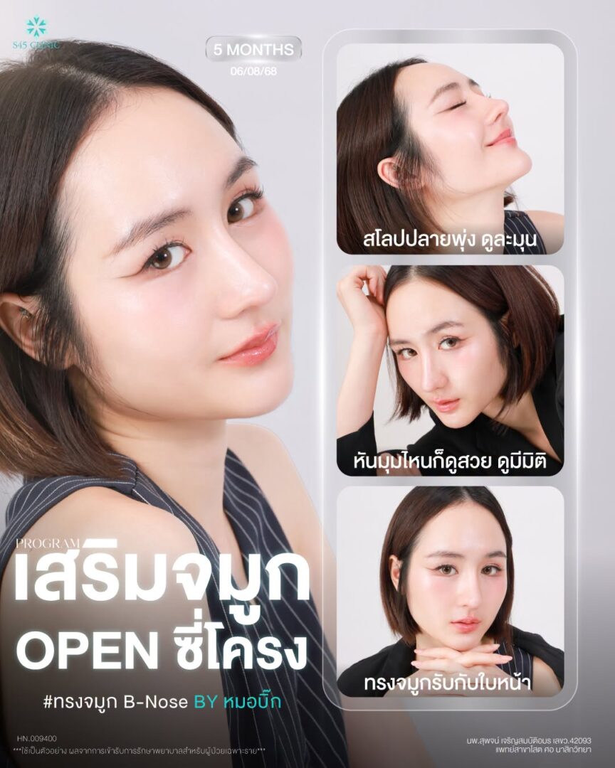 ทรงจมูกปลายเชิดธรรมชาติ