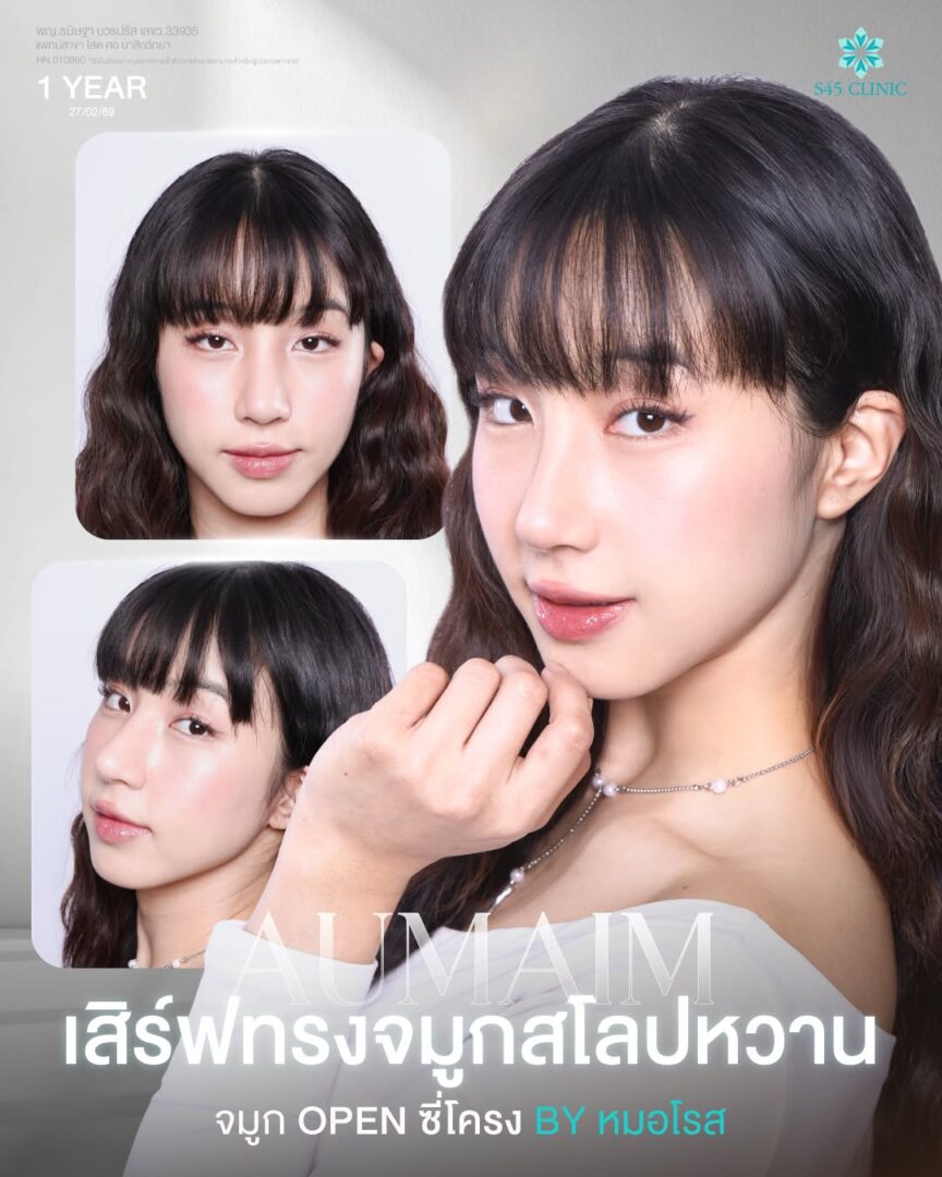 ทรงจมูกสโลปหวาน open