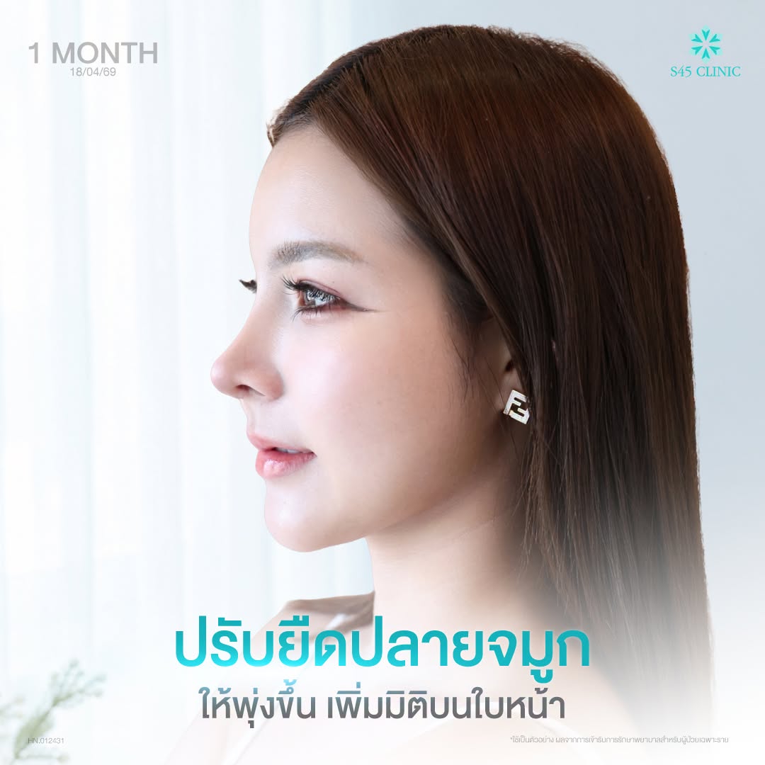 ทรงจมูกเกาหลี
