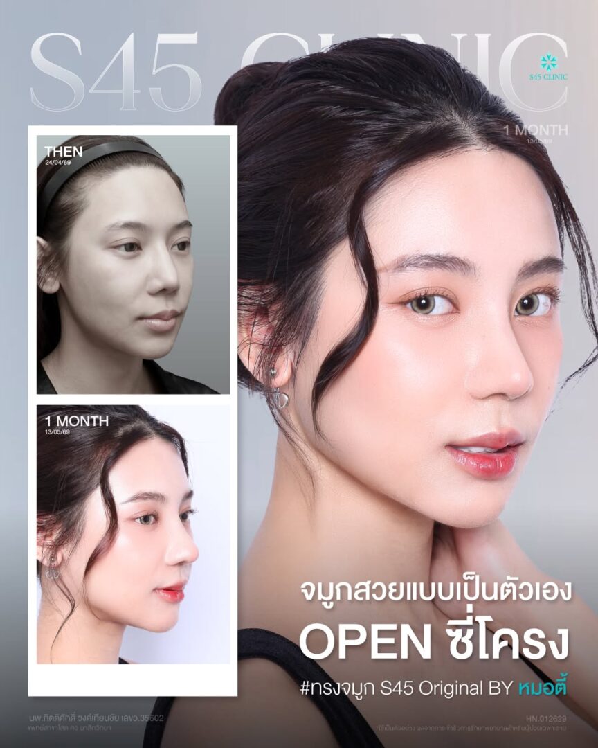 ทรงเกาหลีปลายเชิด