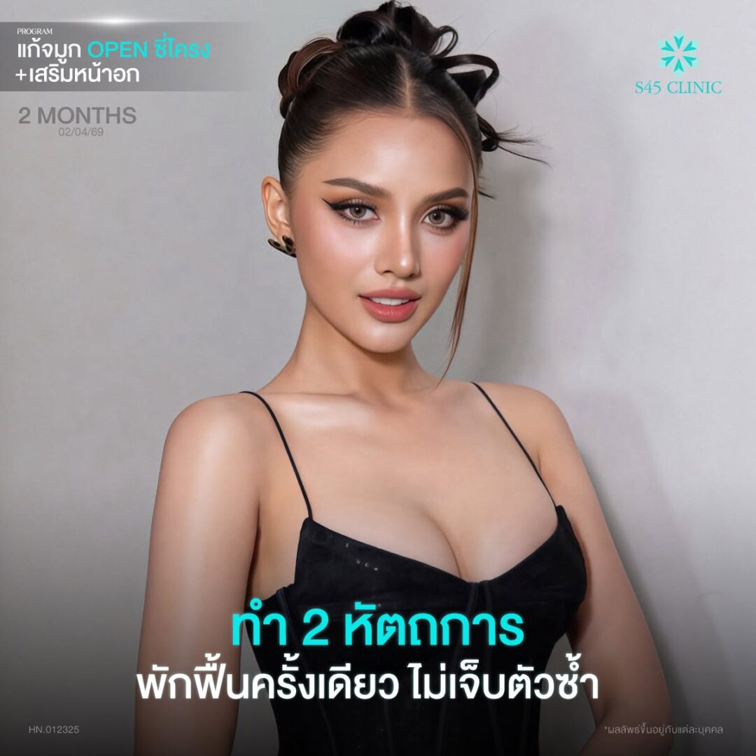 ศัลยกรรม2หัตถการพร้อมกัน