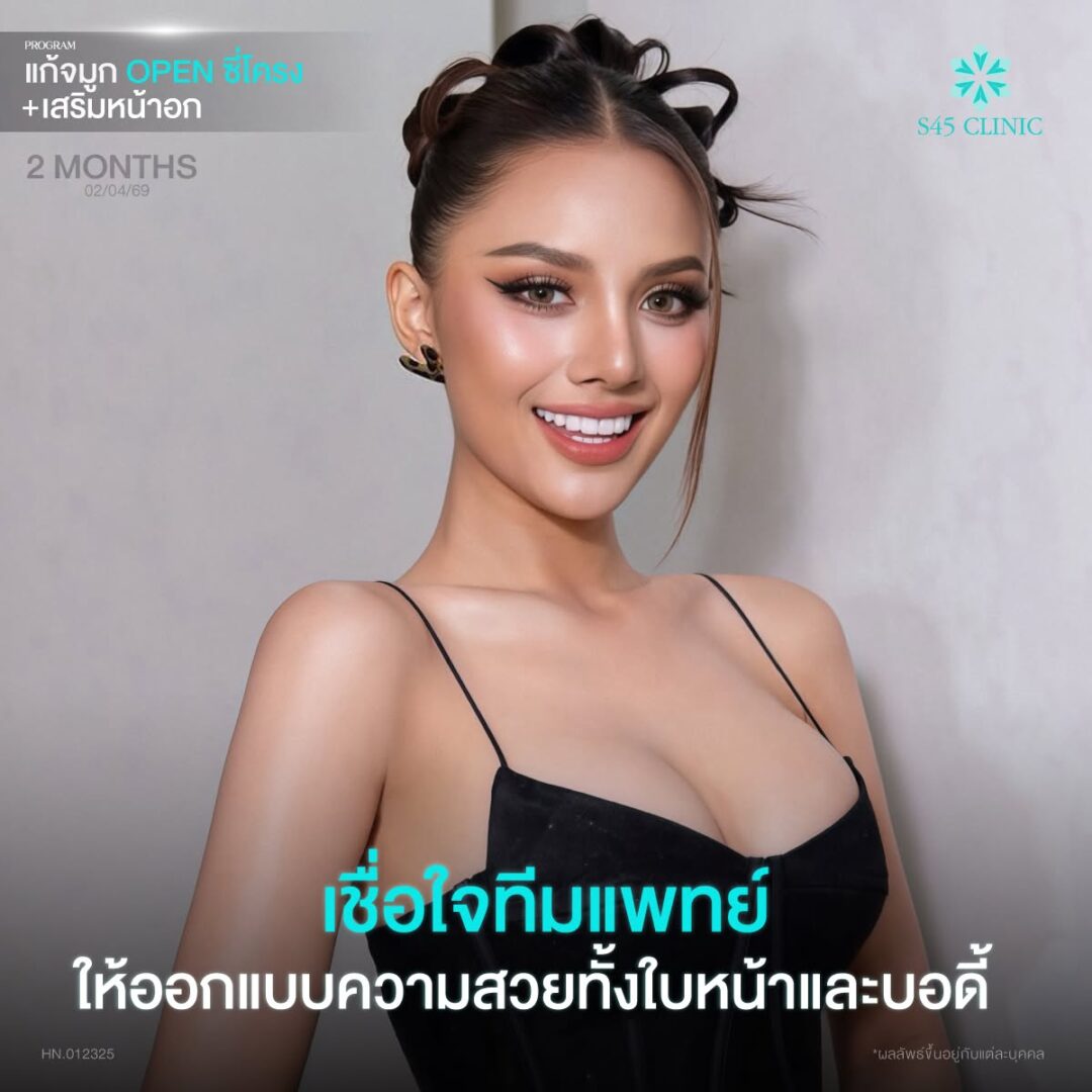 เสริมจมูกพร้อมเสริมหน้าอก ที่ S45 Clinic
