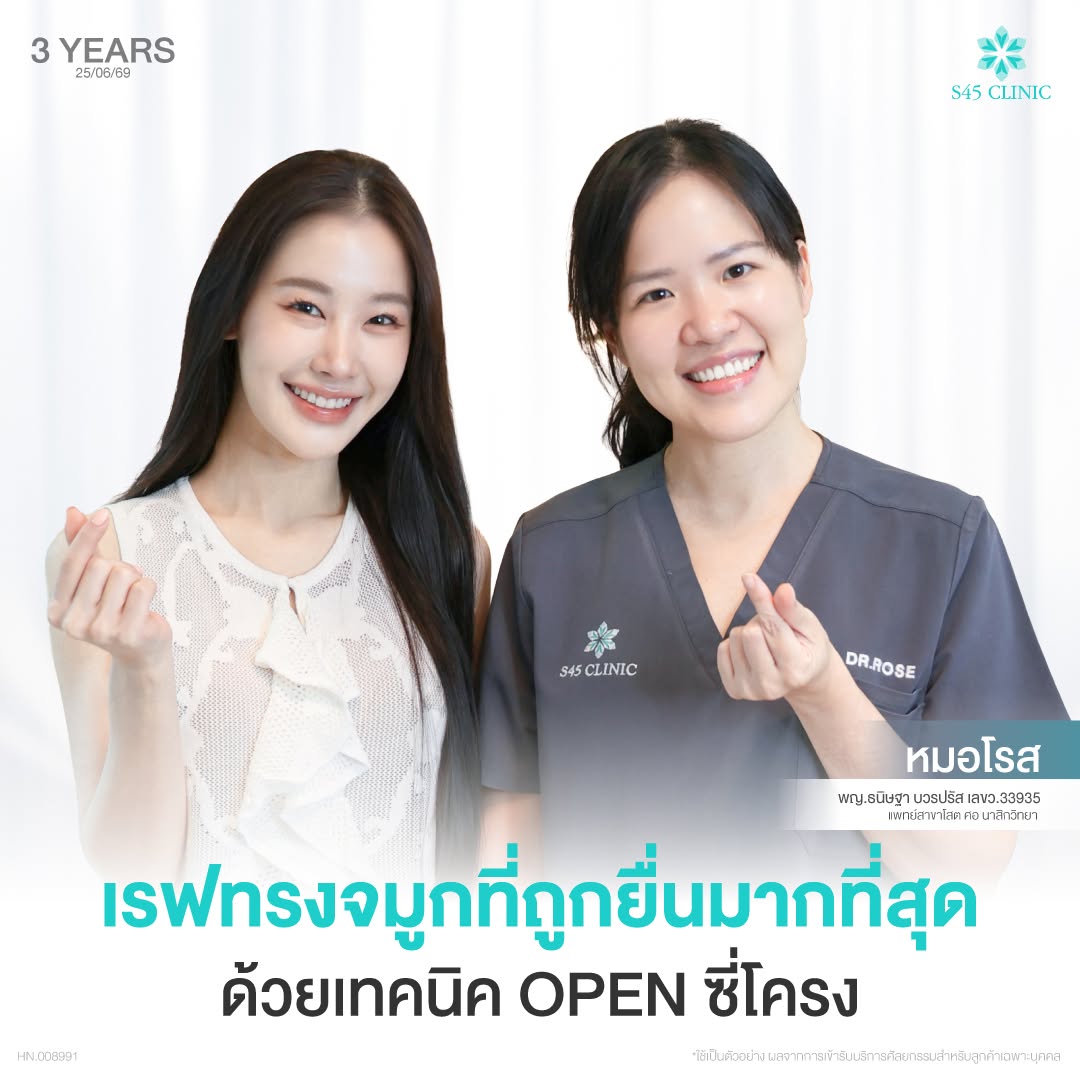 เสริมจมูกโอเพ่นซี่โครง S45 Clinic