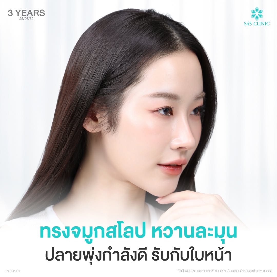 เสริมจมูกโอเพ่นซี่โครง ทรงจมูกหวานละมุน