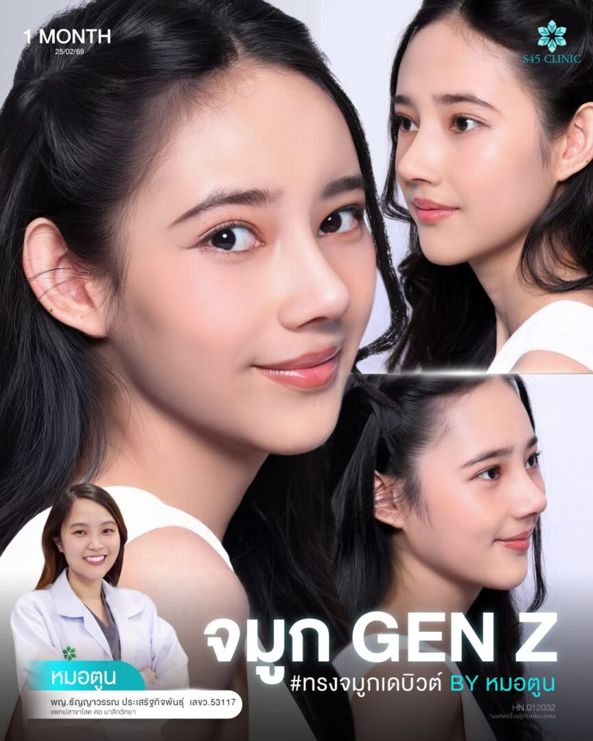 เสิรมจมูก gen z