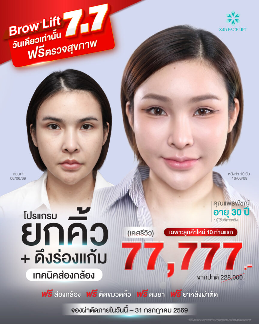 โปรแกรมยกคิ้ว ดึงร่องแก้ม