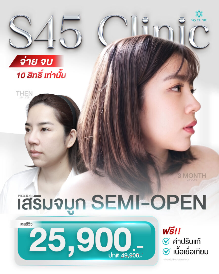 โปรโมชั่น Semi OPEN