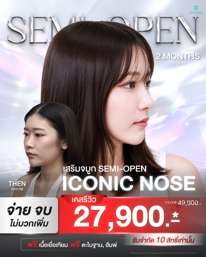 โปรโมชั่น เสริมจมูก semi open